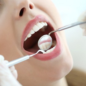 woman at dental exam