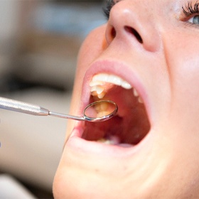dental checkup