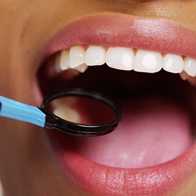 Closeup of patient during dental treatment