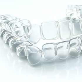 Invisalign aligner