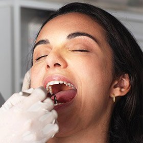 Woman receiving oral cancer screening