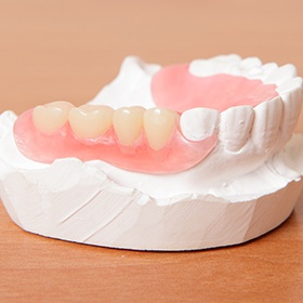 Model smile with partial denture